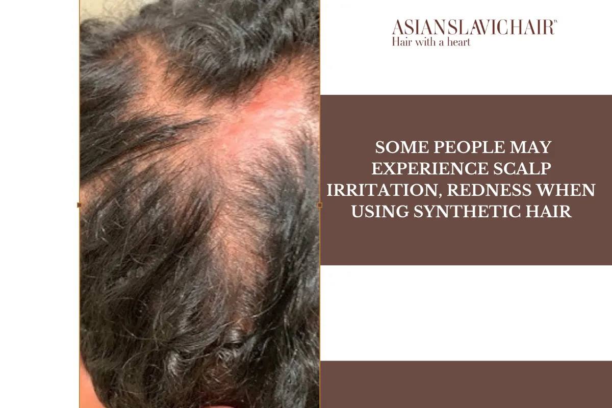Some people may experience scalp irritation, redness when using Synthetic hair.