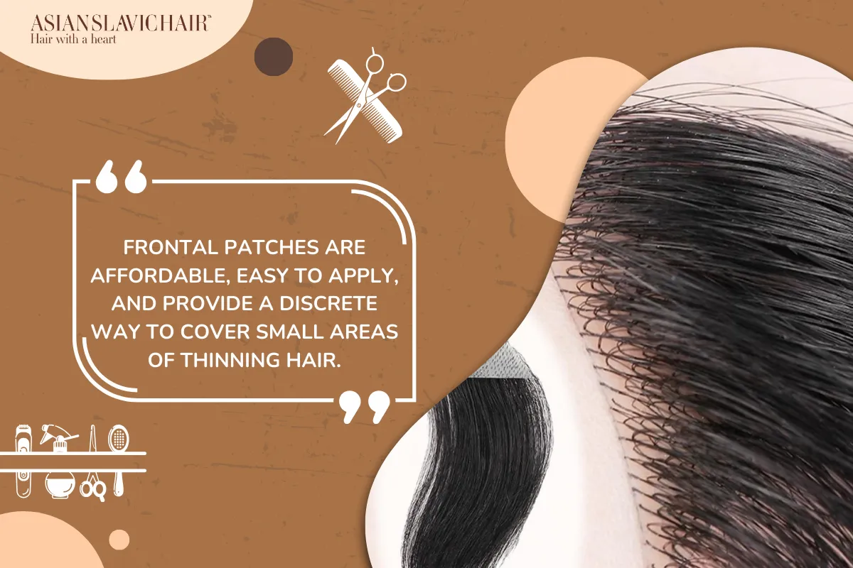 Frontal patches are affordable, easy to apply, and provide a discrete way to cover small areas of thinning hair.
